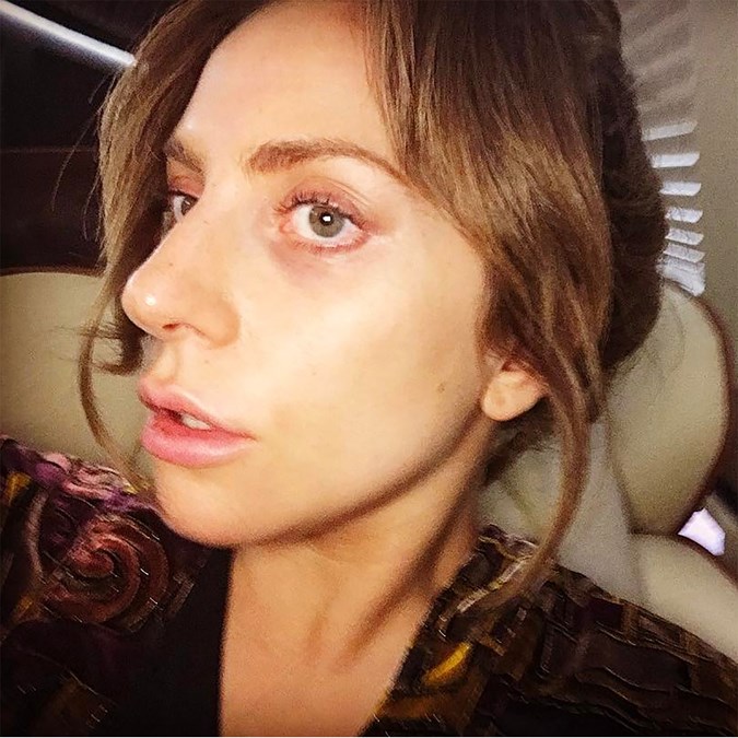 Lady-Gaga-makeup-free