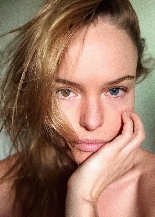 Latest High-Tech Professional Skin Treatments - Kate Bosworth