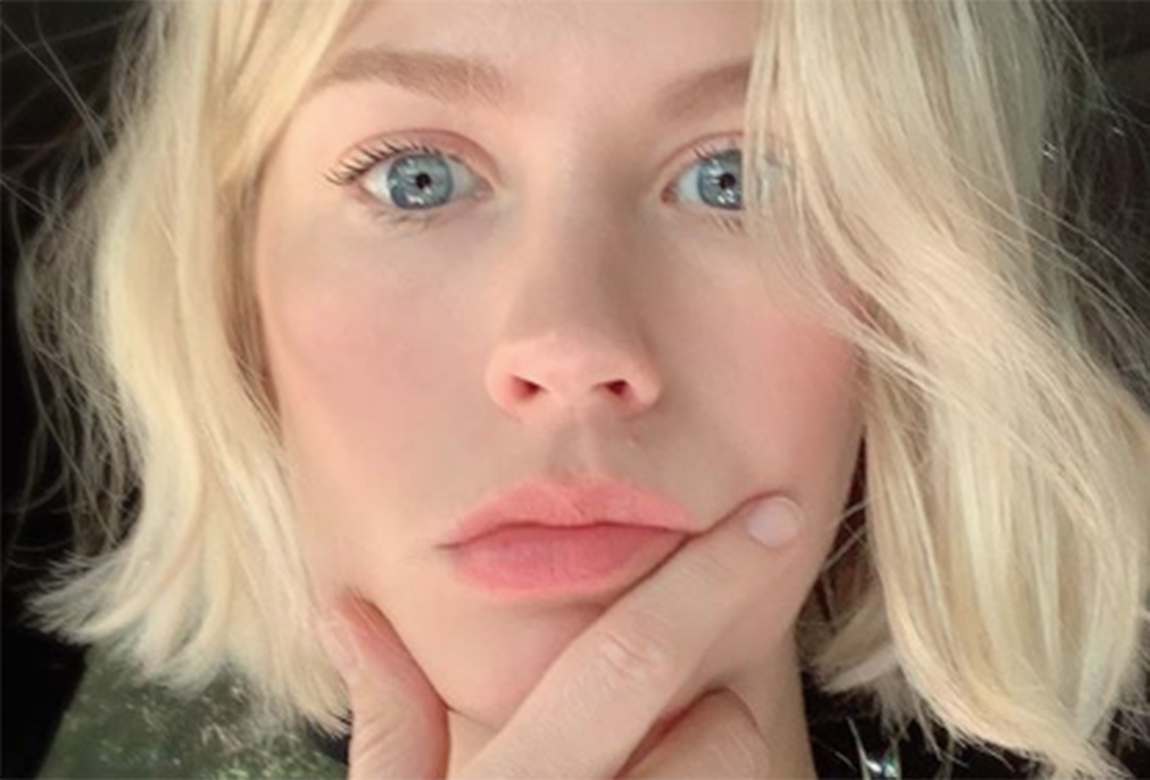 concealer to hide pigmentation