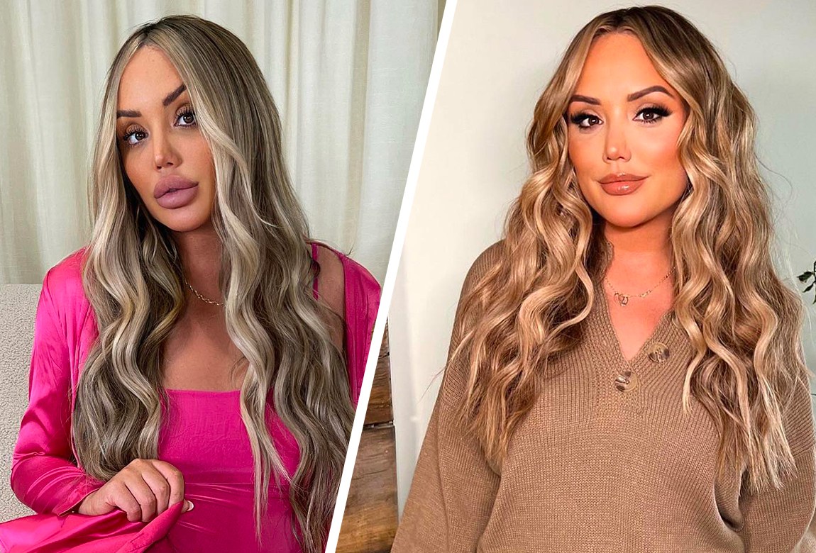 Celebrities Are Getting Their Lip Fillers Dissolved BEAUTY/crew